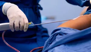 liposuccion-clinica-rinos-barcelona-tarragona.jpg
