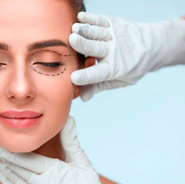 Unidad de Oculoplastia